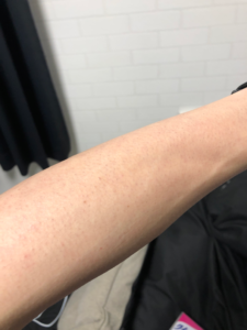 【RBL】ローランドビューティーラウンジにて全身脱毛はじめてみた【感想】