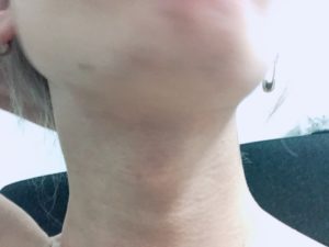 【効果検証】RBLで4回目のメンズ全身脱毛に行ってきた【SHR脱毛】