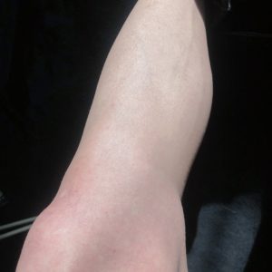 【自粛中で太ってしまった？】引きこもっていても痩せる1つの方法