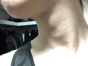 【検証】ローランドの脱毛サロンで脱毛6回目を2週間放置してみた【SHR脱毛】