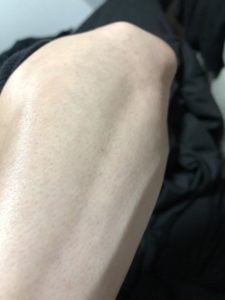 【RBL】ローランドの脱毛サロンで7回目の施術を2週間放置してみた【記録】