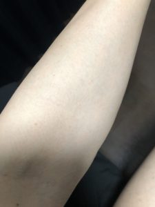 【メンズ脱毛】RBLで全身脱毛8回目を2週間放置してみた【効果検証】