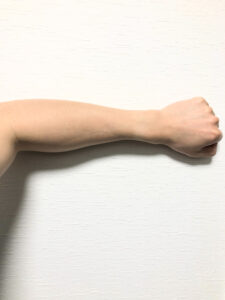 【効果は？】ローランドの脱毛サロンに15回通った結果【RBL】