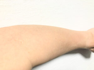 【RBL】ローランドの脱毛サロンに通いだして1年3か月経過した【効果は？】