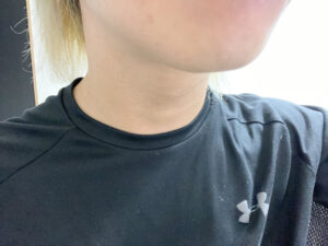 【検証】RBLの脱毛サロンで19回目の施術をして1カ月放置した結果