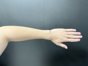 【20回目】RBL脱毛を20回通った僕が答える驚きの効果とは？