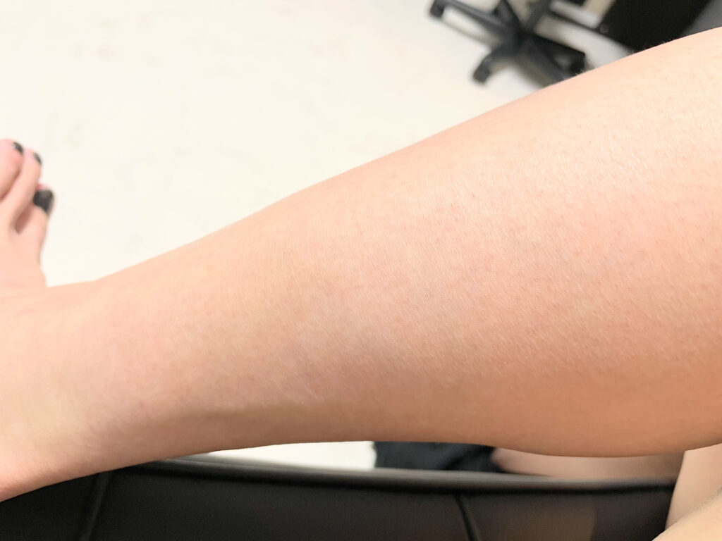 ローランドの脱毛サロンで脱毛21回して3週間放置してみた【気になる効果】