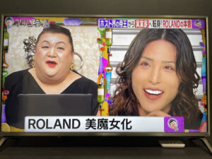 ローランドの脱毛サロンで脱毛21回して2ヶ月放置してみた【気になる効果】