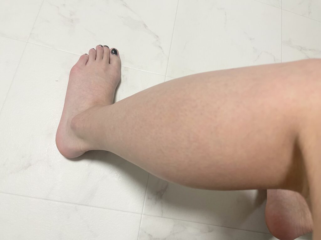 【ぶっちゃけどう？】ローランドの脱毛サロンで22回目の脱毛をして3週間経過した結果