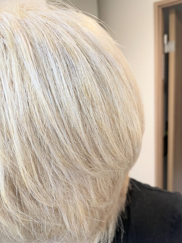 【レビュー】レプロナイザー27Dを使ってみたけど効果がすごすぎる件【口コミ】