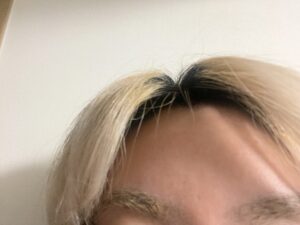 【JOLEN】10年以上眉毛を脱色している私がコツを教えてみた【ビフォーアフター】