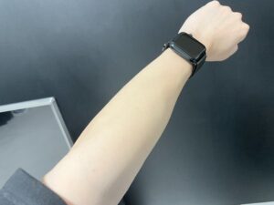 【2週間経過】セルフ脱毛ぶっちゃけどう？結構いいかも？【やり方と注意点有】