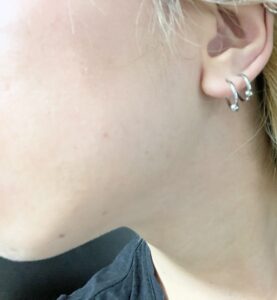 【マナブさん肌質改善記事に反論】結局肌には何もしないことが最も大事な件【体質もあり】