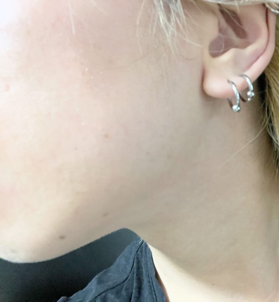 【マナブさん肌質改善記事に反論】結局肌には何もしないことが最も大事な件【体質もあり】