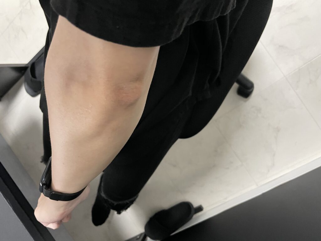 【アラサー】メンズセルフ脱毛26回目を1カ月放置した結果