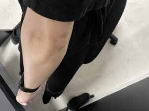 【アラサー】メンズセルフ脱毛26回目を1カ月放置した結果