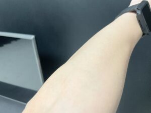 【医療脱毛には敵わん】美容脱毛を30回以上通って数か月放置した結果