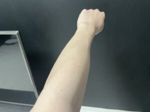 【まだやるのか】メンズ全身脱毛を多分「32回目」くらいまで受けてきた結果