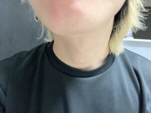 【ついに終了】30代普通毛男性が全身脱毛を完全に終わる回数は大体33回