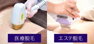 【医療脱毛一択】脱毛をいくら回数重ねても終わらない理由【詐欺】