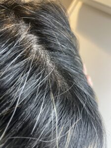 【検証】レプロナイザー107Dは白髪に効果ある？2カ月使ってみた結果【結論：効果なし】